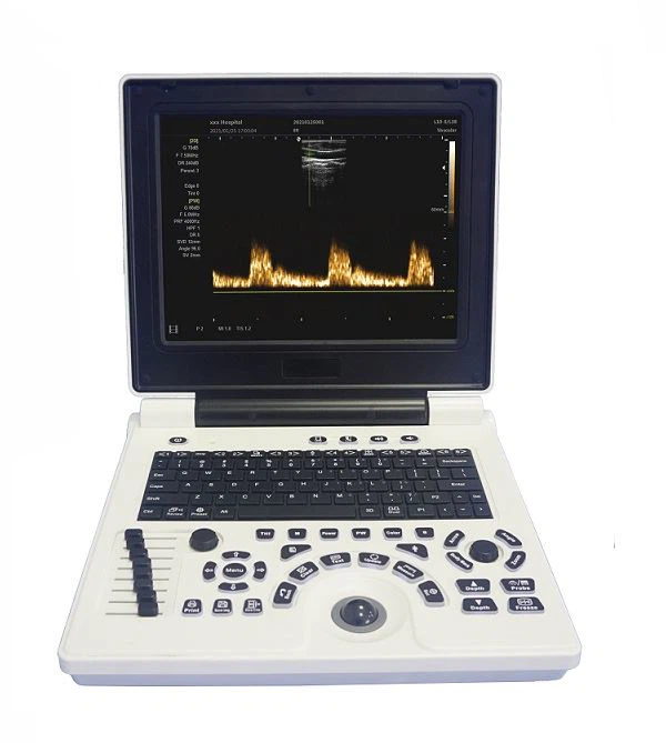 ULTRASONIDO PORTATIL SISTEMA DE DIAGNOSTICO ULTRASONICO DOPPLER COLORS