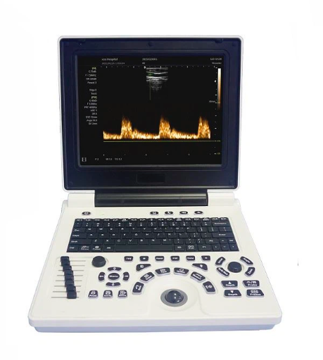 ULTRASONIDO PORTATIL SISTEMA DE DIAGNOSTICO ULTRASONICO DOPPLER COLORS